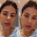 Simone Mendes muda o nariz sem rinoplastia; veja como funciona e quanto custa o procedimento
